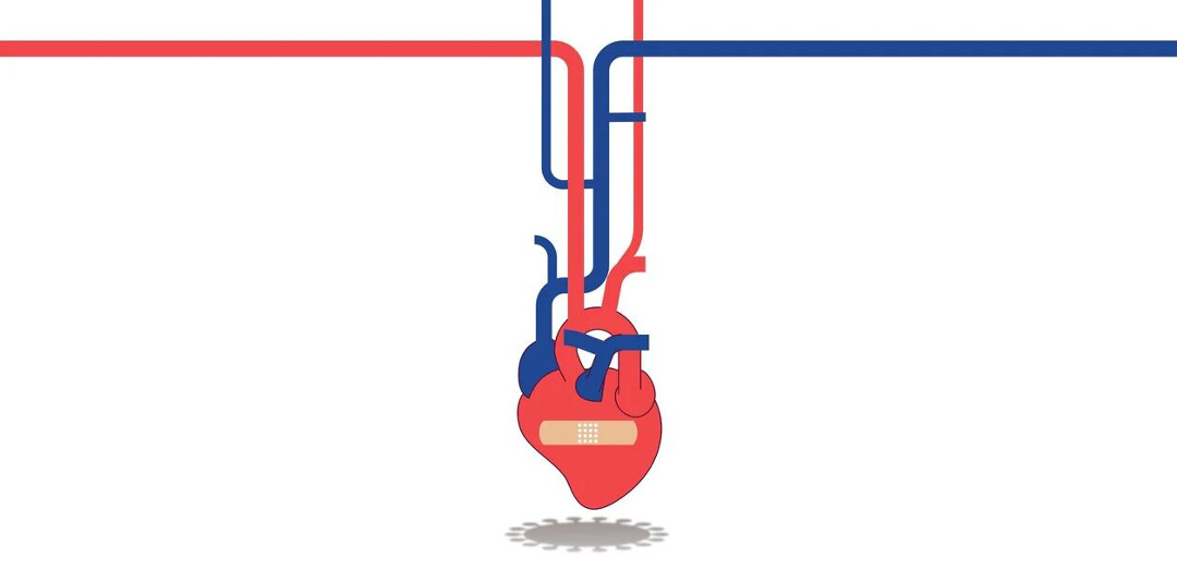 Corazón y coronavirus: por qué el Covid dispara el número de infartos