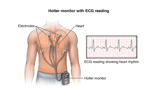 Estudio de Holter Cardiaco | Grupo Boskis