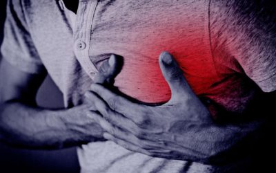 Infarto Agudo de Miocardio: ¿Qué es y cuáles son sus síntomas?