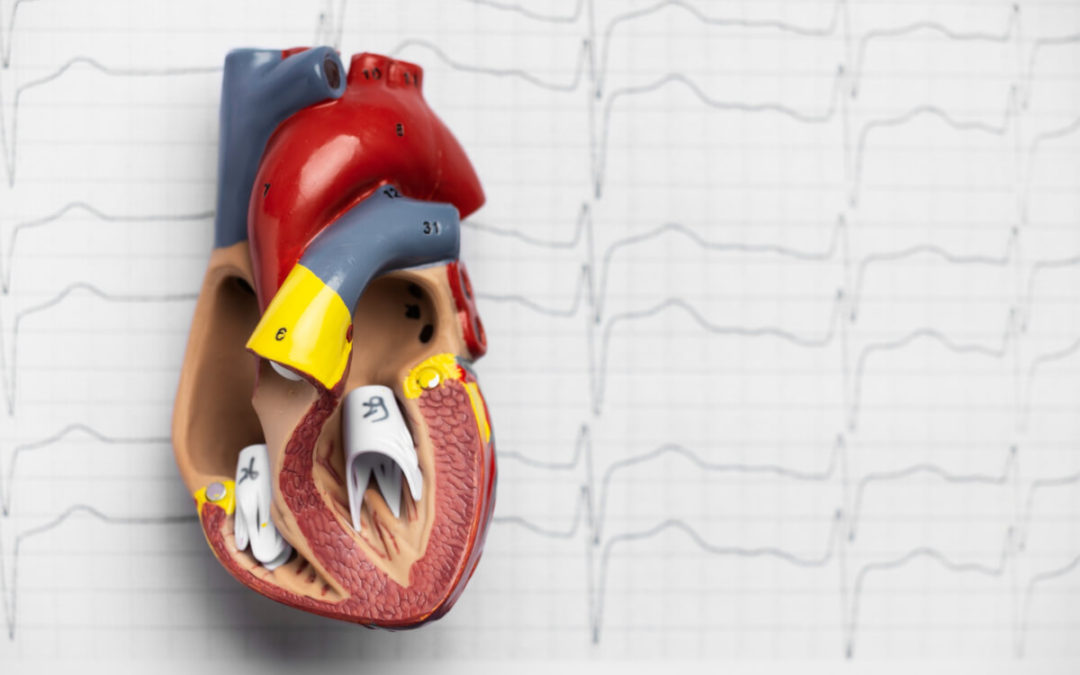 ¿Qué es la arritmia cardiaca? Causas, síntomas y tratamientos