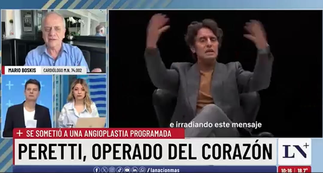 Diego Peretti fue sometido a una angioplastía programada